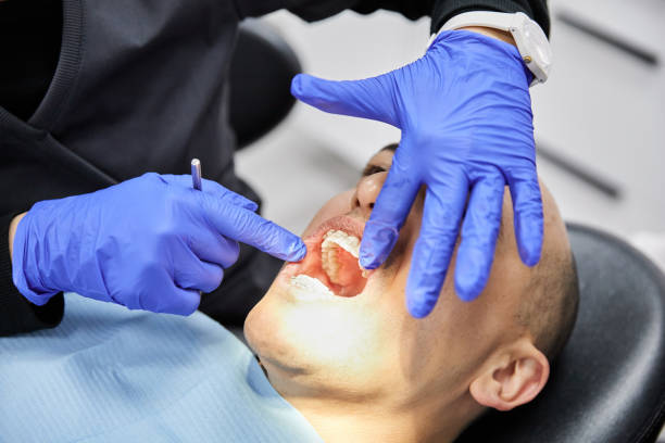 Best Emergency Broken Tooth Repair in Arlington, TX