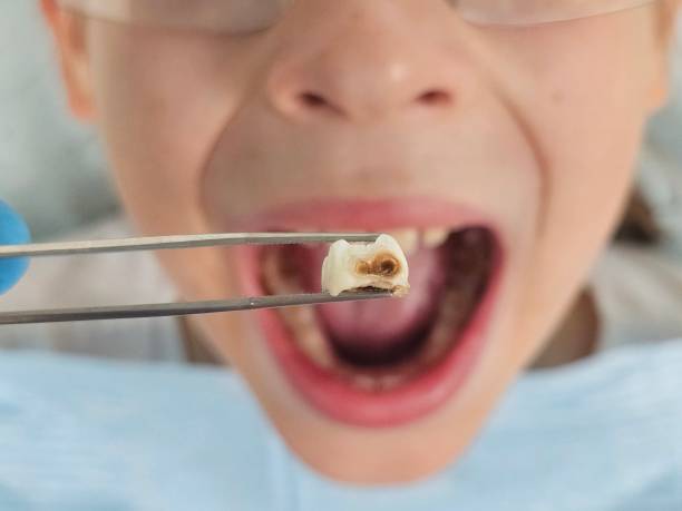 Best Emergency Treatment for Toothache in Arlington, TX